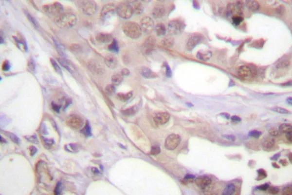 CDK7 Rabbit Polyclonal Antibody - image 1