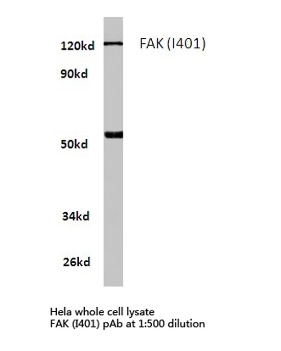 FAK (PTK2) Rabbit Polyclonal Antibody - image 1