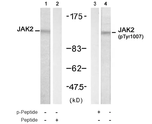 JAK2 Rabbit Polyclonal Antibody - image 1
