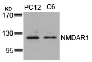 NMDAR1 (GRIN1) Rabbit Polyclonal Antibody - image 1