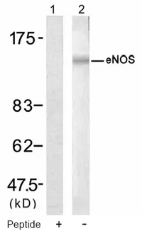 eNOS (NOS3) Rabbit Polyclonal Antibody - image 1