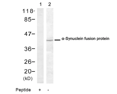 alpha Synuclein (SNCA) Rabbit Polyclonal Antibody - image 1