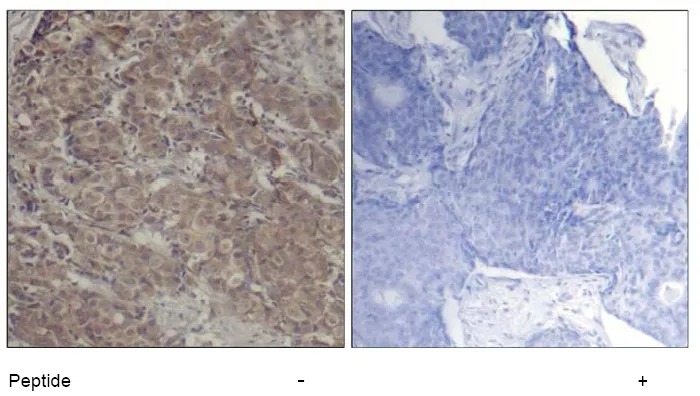CREB1 Rabbit Polyclonal Antibody - image 1