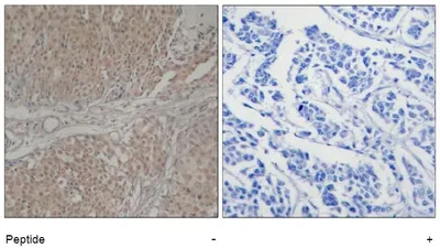 SMAD3 Rabbit Polyclonal Antibody - image 1