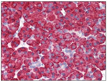MDA5 (IFIH1) Rabbit Polyclonal Antibody - image 1