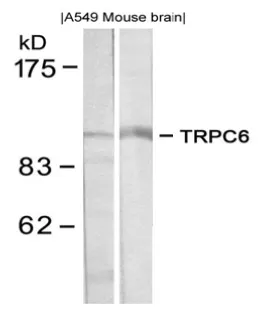 TRPC6 Rabbit Polyclonal Antibody - image 1