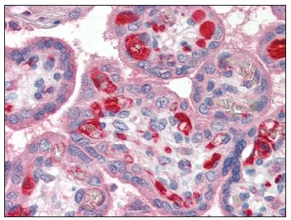 PLTP Rabbit Polyclonal Antibody - image 1