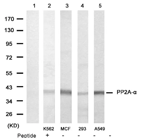 PP2A-alpha (PPP2CA) Rabbit Polyclonal Antibody - image 1