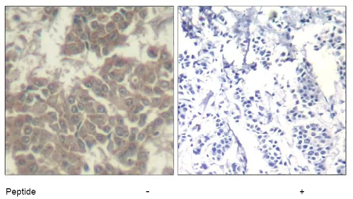 JAK2 Rabbit Polyclonal Antibody - image 1