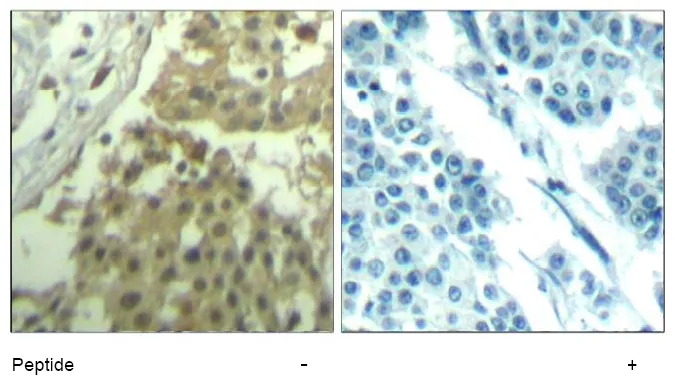 CDK1 Rabbit Polyclonal Antibody - image 1