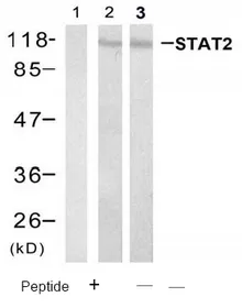 STAT2 Rabbit Polyclonal Antibody - image 1