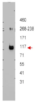 ABCB5 Rabbit Polyclonal Antibody - image 1