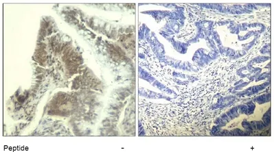 CDK6 Rabbit Polyclonal Antibody - image 1