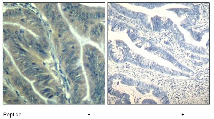 CDK6 Rabbit Polyclonal Antibody - image 1