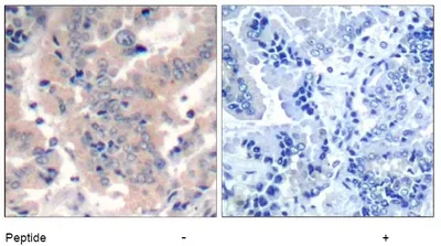 PI 3 Kinase p85 alpha (PIK3R1) (alpha/gamma/beta) Rabbit Polyclonal Antibody - image 1
