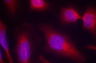 Tau (MAPT) Rabbit Polyclonal Antibody - image 1