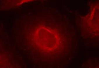 NMDAR2B (GRIN2B) Rabbit Polyclonal Antibody - image 1