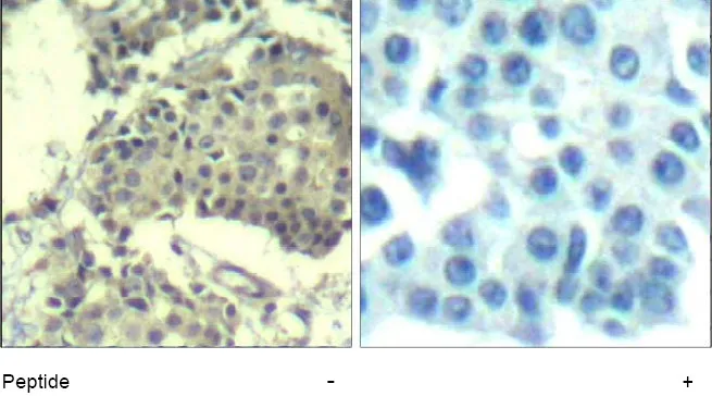 MTOR Rabbit Polyclonal Antibody - image 1