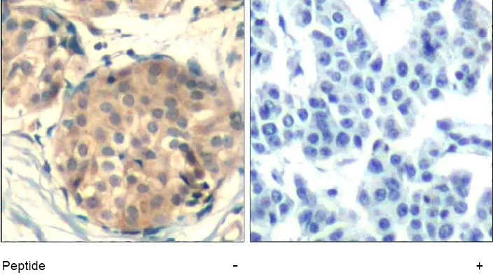 c Kit (KIT) Rabbit Polyclonal Antibody - image 1