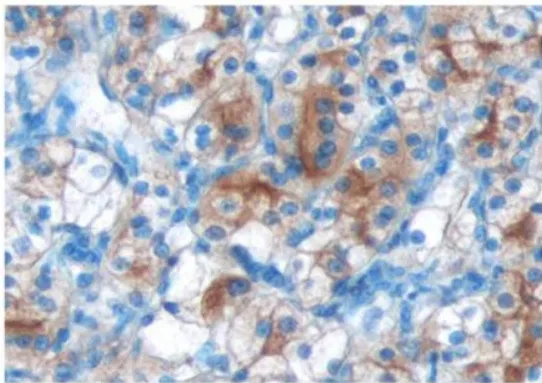 LRP2 Rabbit Polyclonal Antibody - image 1
