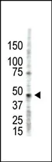 PRMT2 (N-term) Rabbit Polyclonal Antibody - image 1