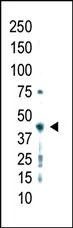 PRMT2 (C-term) Rabbit Polyclonal Antibody - image 1
