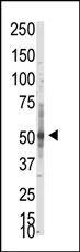 PRMT3 (N-term) Rabbit Polyclonal Antibody - image 1