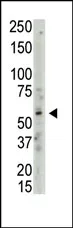 PRMT3 (C-term) Rabbit Polyclonal Antibody - image 1