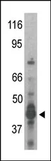 PRMT6 (N-term) Rabbit Polyclonal Antibody - image 1