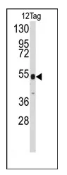 Pk (V5) Epitope Tag (GKPIPNPLLGLDST) Rabbit Polyclonal Antibody - image 1