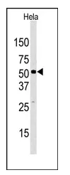 KDM4D (C-term) Rabbit Polyclonal Antibody - image 1