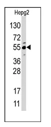 JMJD4 (N-term) Rabbit Polyclonal Antibody - image 1