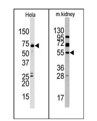 JMJD4 (C-term) Rabbit Polyclonal Antibody - image 1