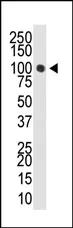 DNMT3A Rabbit Polyclonal Antibody - image 1