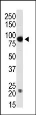 DNMT3B Rabbit Polyclonal Antibody - image 1