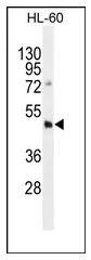 DNMT3L (C-term) Rabbit Polyclonal Antibody - image 1