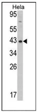 Dnmt3l Rabbit Polyclonal Antibody - image 1