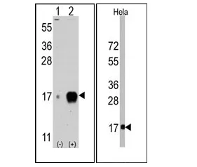 IFITM3 Rabbit Polyclonal Antibody - image 1