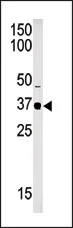 SETD7 (C-term) Rabbit Polyclonal Antibody - image 1