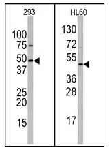 SUV39H2 / KMT1B (C-term) Rabbit Polyclonal Antibody - image 1