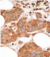 Bcl G (BCL2L14) (BH3 Domain) Rabbit Polyclonal Antibody - image 1