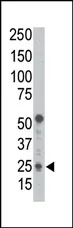 Bcl2 Binding component 3 (BBC3) (BH3 Domain) Rabbit Polyclonal Antibody - image 1