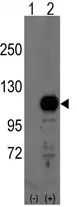 BCAS3 (C-term) Rabbit Polyclonal Antibody - image 1
