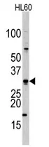 CDCA8 Rabbit Polyclonal Antibody - image 1