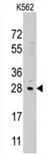 LIN28B Rabbit Polyclonal Antibody - image 1
