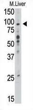 TLR6 (C-term) Rabbit Polyclonal Antibody - image 1