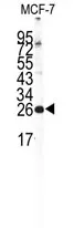 Frequenin (NCS1) Rabbit Polyclonal Antibody - image 1