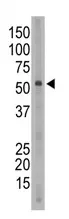 SIGLEC6 (C-term) Rabbit Polyclonal Antibody - image 1