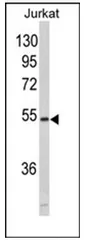 MFAP1 (N-term) Rabbit Polyclonal Antibody - image 1
