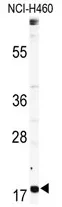 RPL23A (Center) Rabbit Polyclonal Antibody - image 1